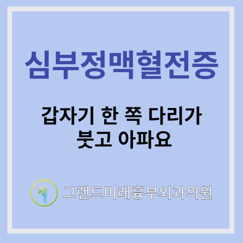 대구 하지 정맥류, 갑작스러운 부종 심부정맥혈전