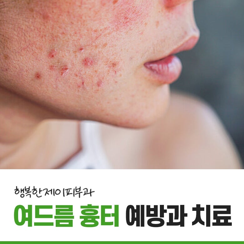 안전하고 부작용이 적은 노원여드름흉터 치료방법은 무엇인가요?