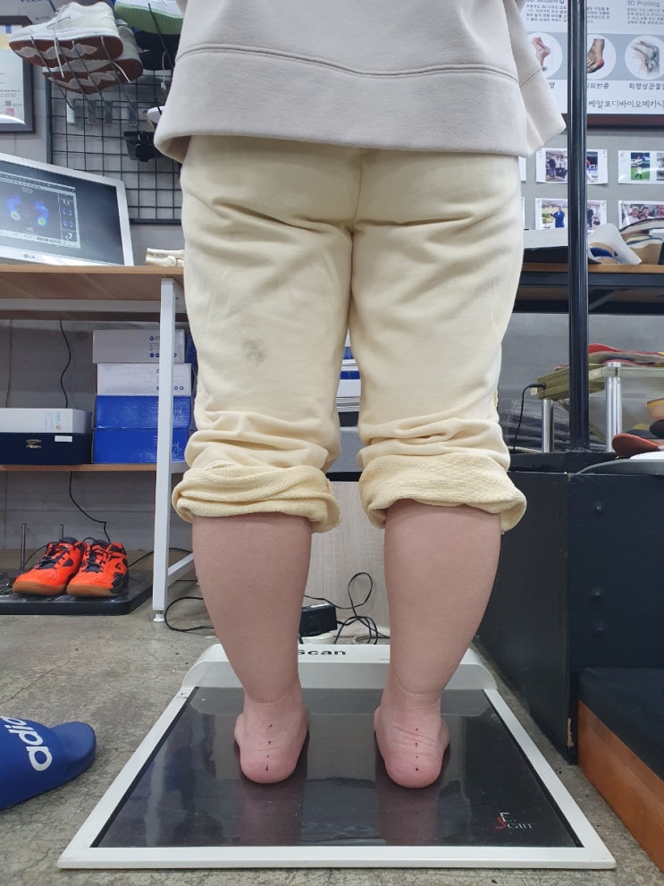  맞춤 깔창, 백화점에서 팔면 뭐가 좀 다를까?