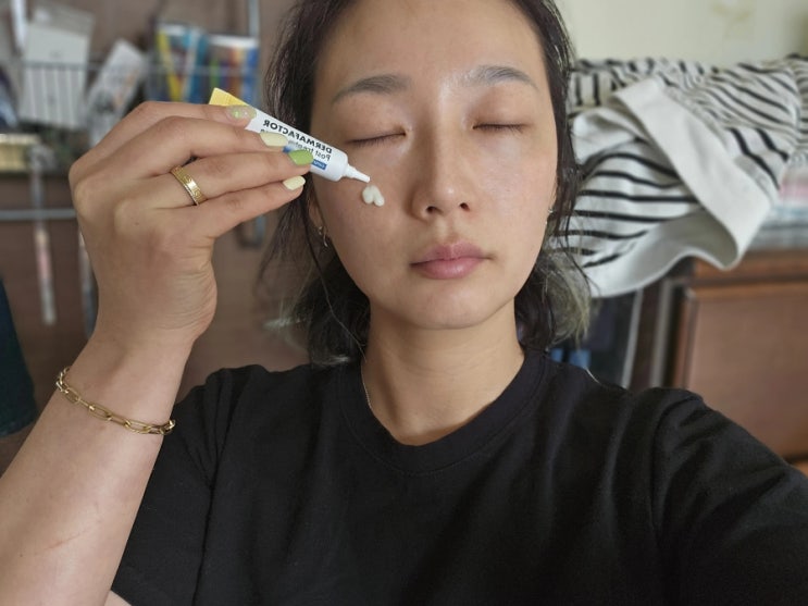  점 흑자 제거 리팟레이저 후 관리 더마팩터 하나면 걱정없어