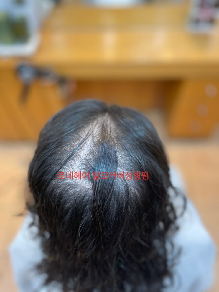 부산사상르네시떼미용실에서탈모파마하면 요랬는데 요래됫슴다/ 사상구북구진구동구김해시사하구영도구중구연제구금정구기장군해운대구남구서구동래구수영구강서구창원시진해시경상남도
