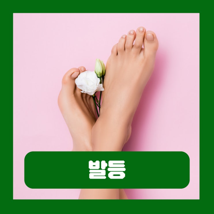 갑자기 발등 통증 유발하는 질환 해결방법
