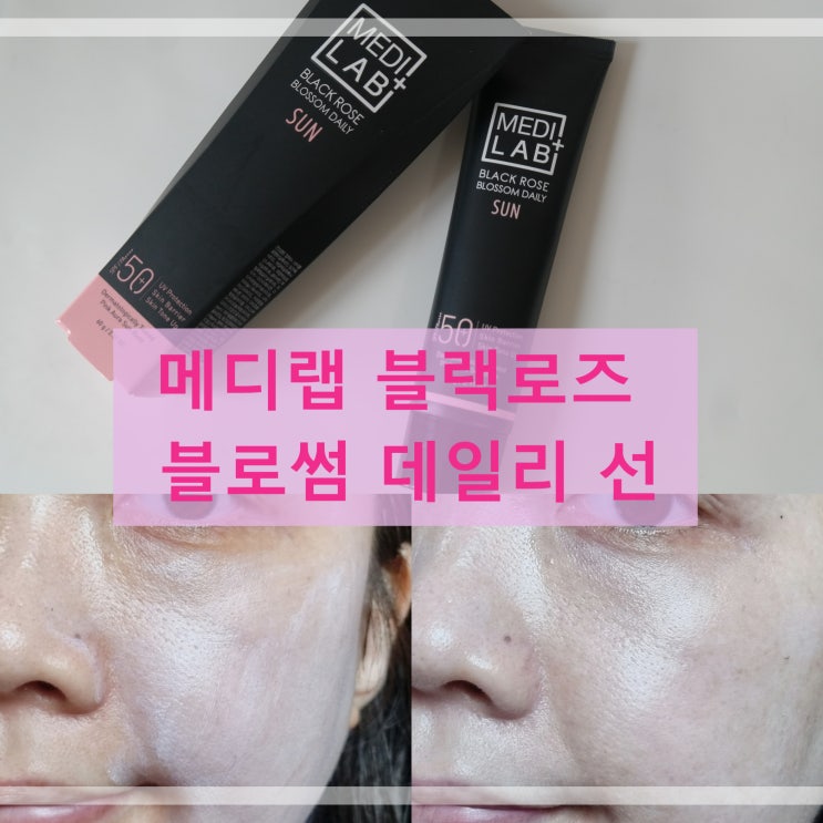  자외선완벽차단 톤업선크림추천 메디랩 블랙로즈 블로썸 데일리 선 사용후기