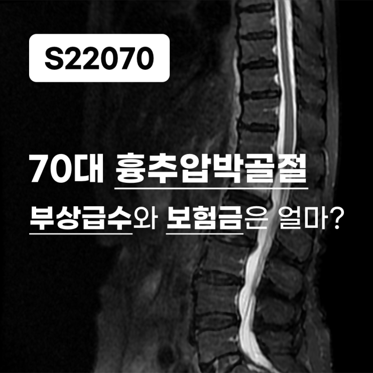  70대(77세) 교통사고 전치8주  S22070 흉추 압박골절시 부상급수와 보험금은 얼마나 될까요?