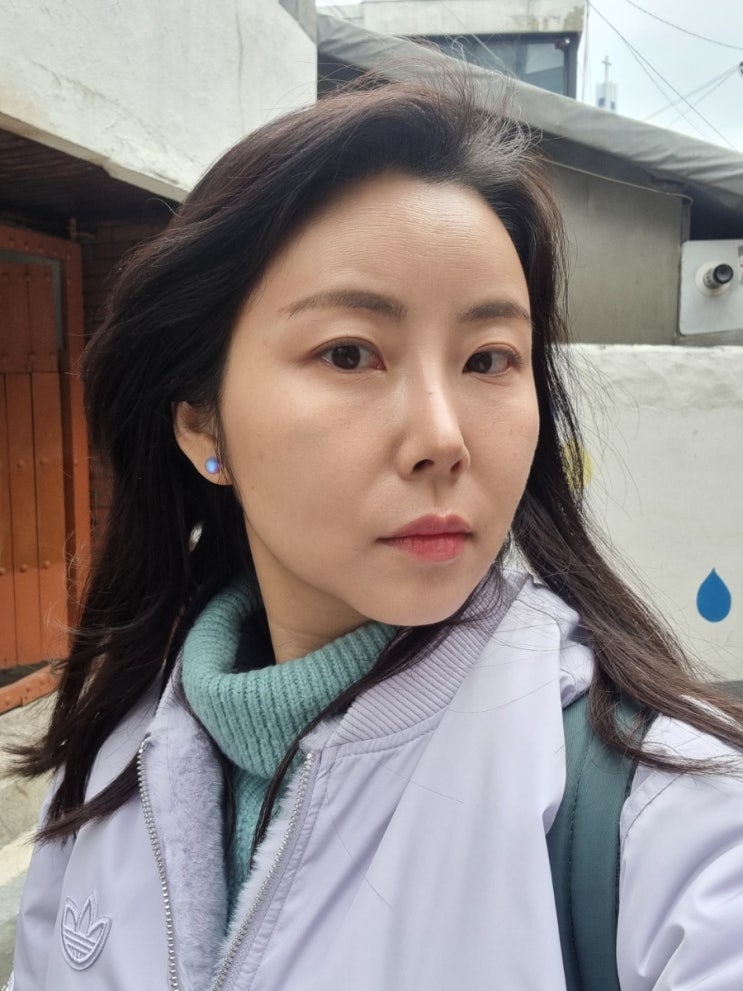 압구정 피부과 / 3회차 지방분해 윤곽주사 조각주사 찐 후기 압구정 피부과 / 3회차 지방분해 윤곽주사 조각주사 찐 후기