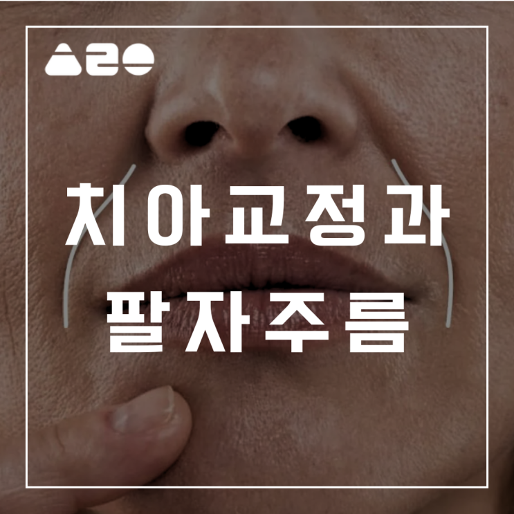  치아교정 후 팔자주름이 더 깊어지나요? 볼패임도 생기는 거 같고, 교정 부작용인가요?