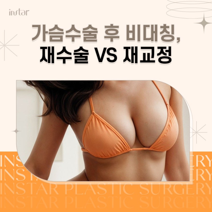  가슴비대칭 수술 후 고민된다면, 재수술 VS 재교정