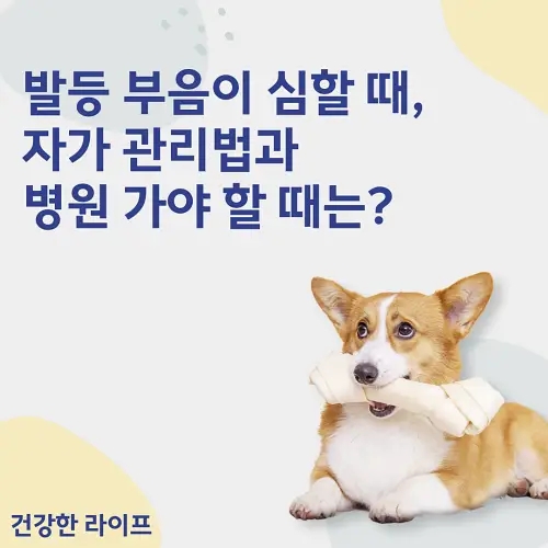  발등 부음이 심할 때, 자가 관리법과 병원 가야 할 때는?