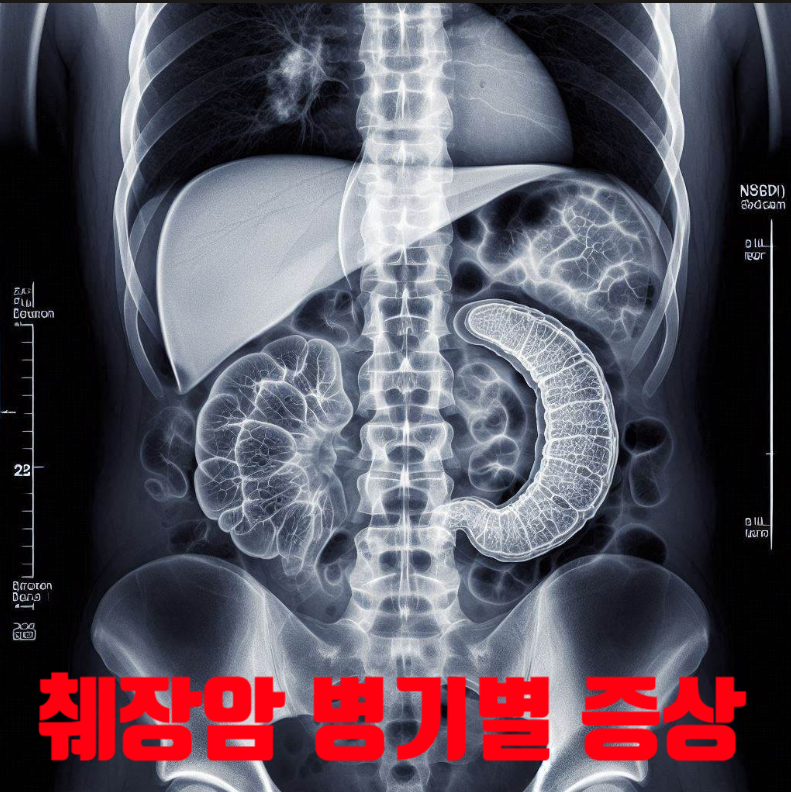췌장암 1기 2기 3기 4기 증상 수술 종류 비용