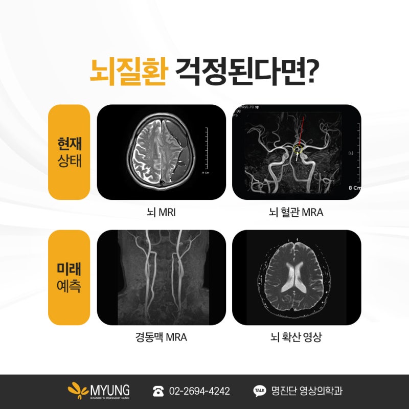 배우 박지아 투병 중이었던 뇌경색 전조증상 및 검사 방법은?