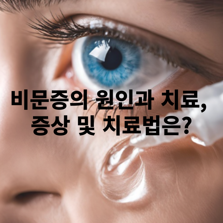  비문증 원인과 치료에 대해서 알아보자~