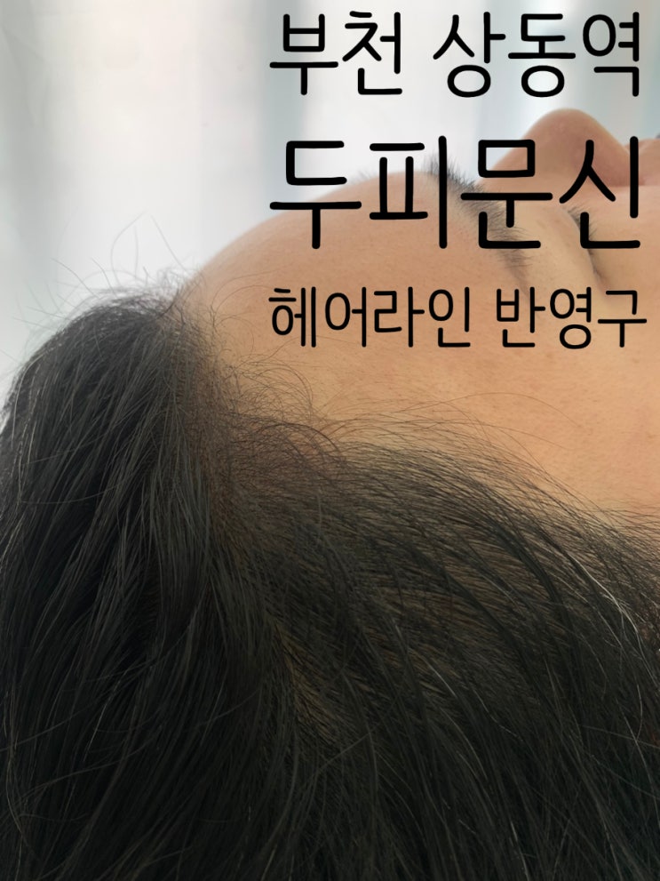  부천 상동역 산후탈모관리 뷰티선셋 헤어라인 반영구 후기와 주의사항