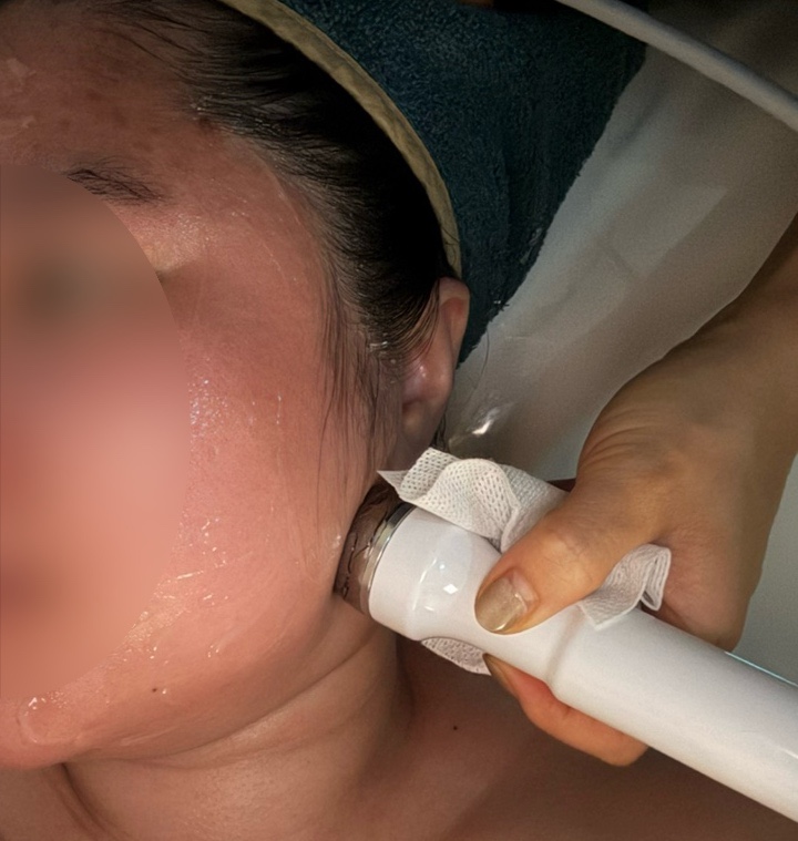  해운대피부관리 질하는, 더함 에스테틱 여드름 관리 후기