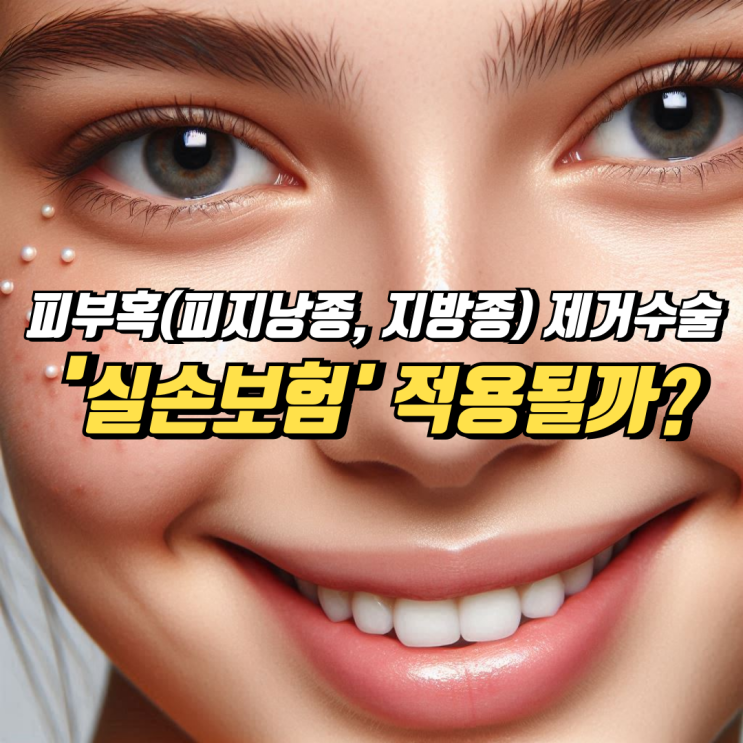  피부혹(피지낭종, 지방종) 제거수술, 실손보험 적용될까?