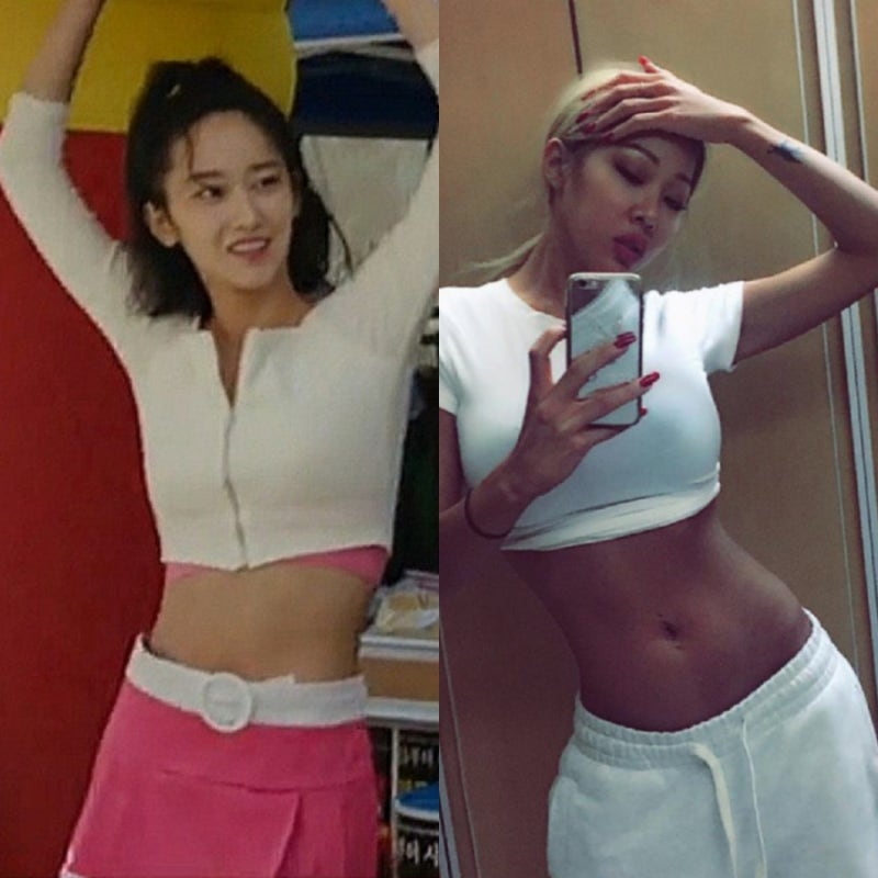 제시 vs 전종서 골반 필러 전후 비교 + 허파고리 시술 가격