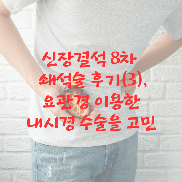  신장결석 8차 쇄석술 후기(3)_요관경 이용한 내시경 수술을 고민하다