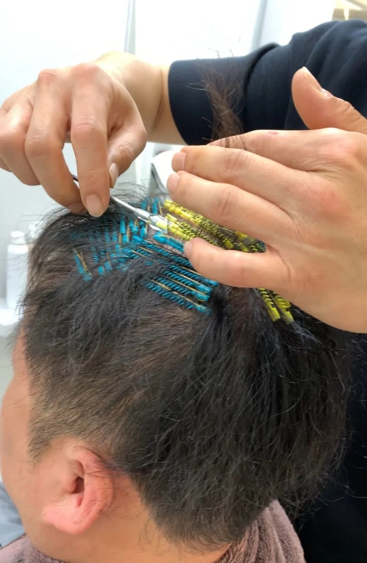  대구 링거펌 숱많아보이는 탈모커버파마 달서구 미용실