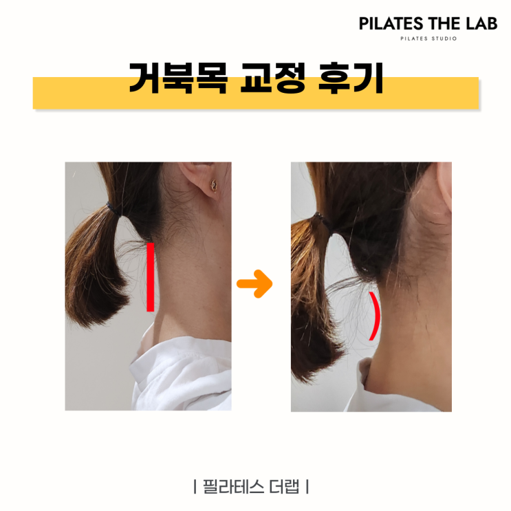  목동 필라테스 거북목 교정 후기