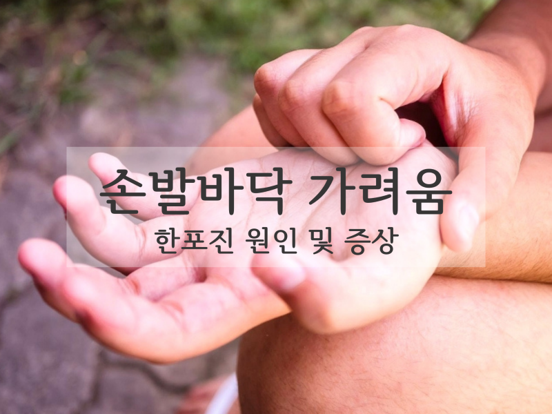 손발바닥 가려움 한포진 원인과 증상 비판텐 연고 좋은 이유