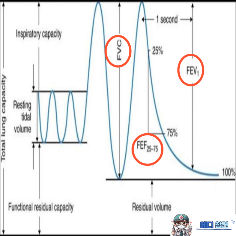 노력성 호기 곡선 FEV1 FVC FEF25-75% FEV1/FVC MIP MEP 의학용어 : 네이버 블로그