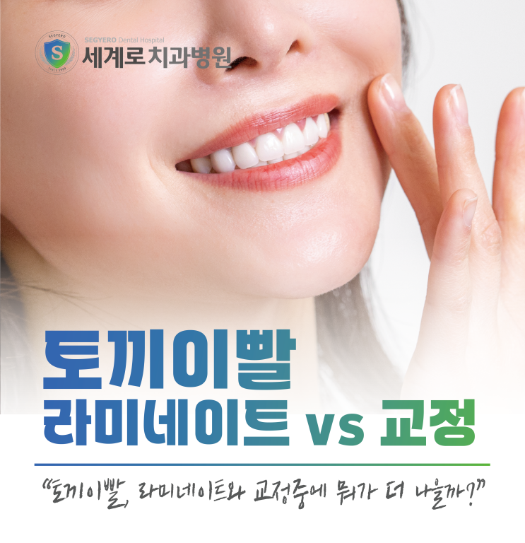  토끼이빨라미네이트와 교정 중 뭐가 나을까? 콤플렉스 해결법