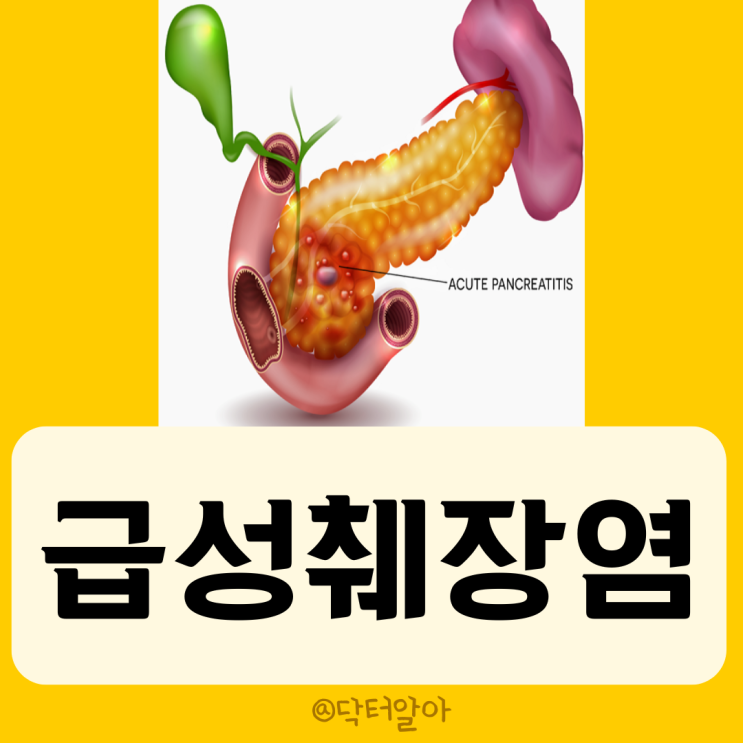 급성 췌장염(Acute pancreatitis)의 정의, 증상, 원인, 진단 및 치료