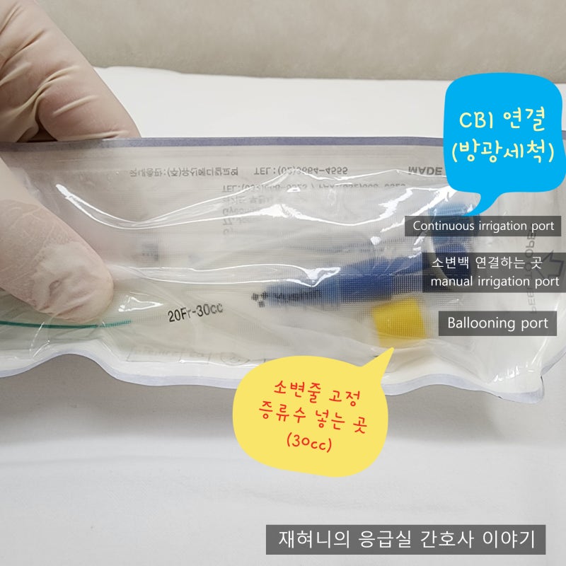 유치도뇨관 삽입과 소변줄 관리 Foley 방광세척 방법