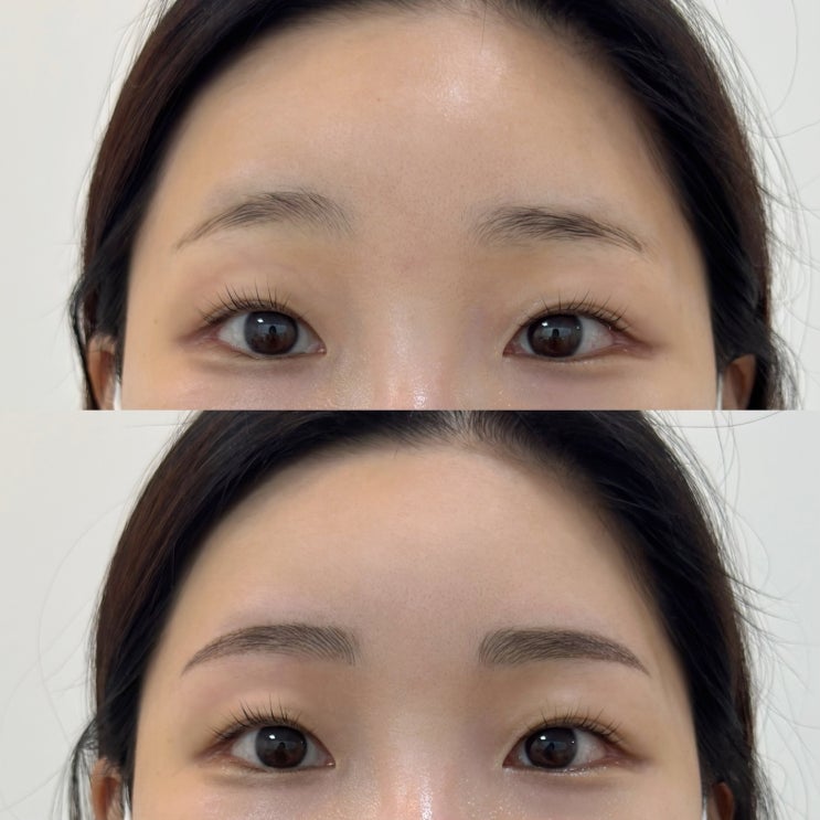  의정부 비대칭 눈썹문신교정은 인브로우