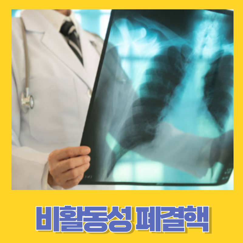 비활동성 폐결핵의 특징 전염성 관리 및 예방