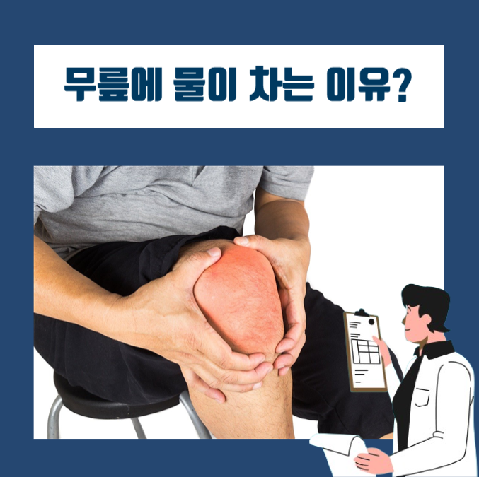  무릎에 물이 찼을 때, 관절삼출, 관절부종의 원인, 증상, 치료