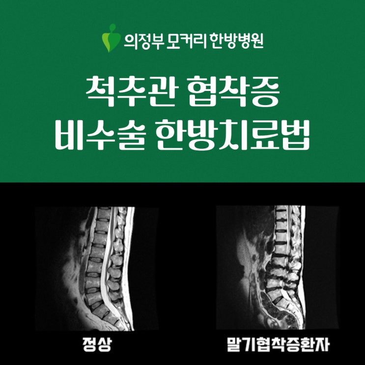  동두천 척추관협착증 원인과 증상 비수술 한방치료법 알아보기 | 의정부 모커리한방병원