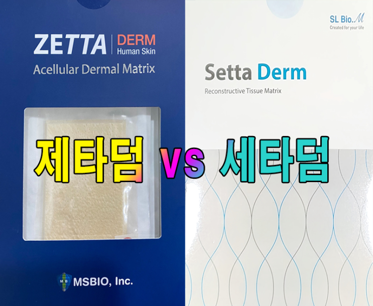  제타덤 vs 세타덤 확대 수술에서 나에게 맞는 진피는?