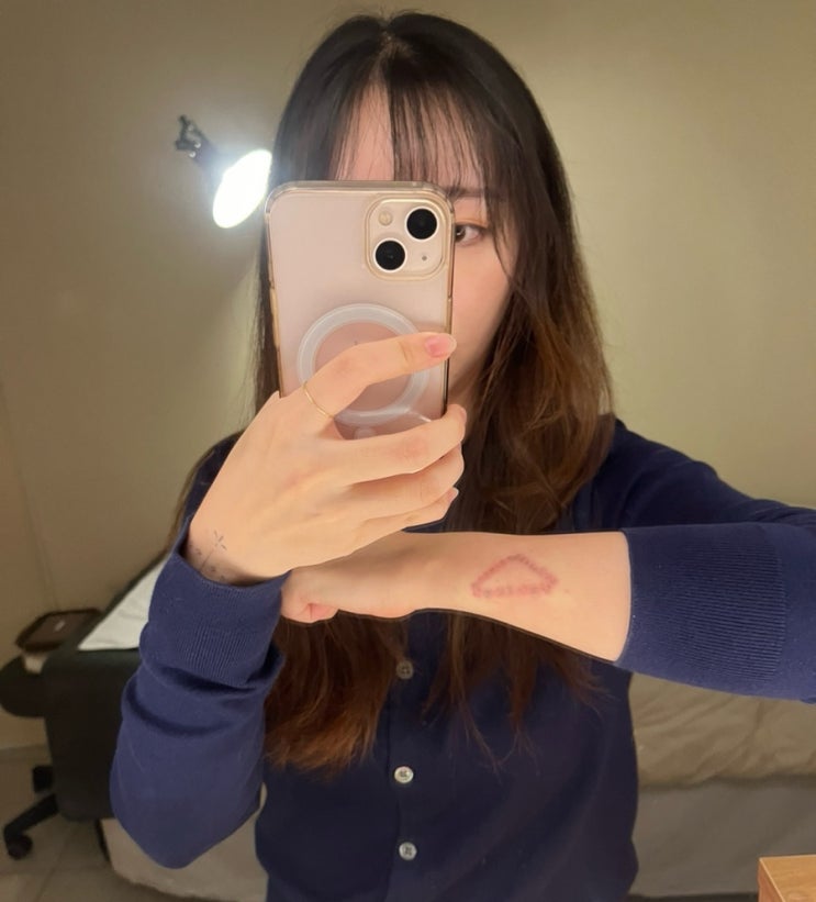  청담동 압구정 피부과 문신 타투 제거 내돈내산 1회차 솔직후기