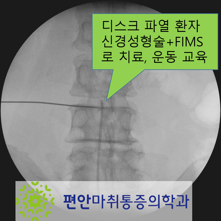 순천 허리 통증으로 병원 진료받았지만 효과 못 본 분들이라면?