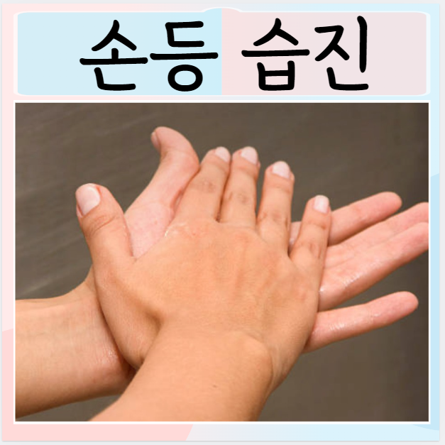  손등습진 증상 치료하는법 손에 습진