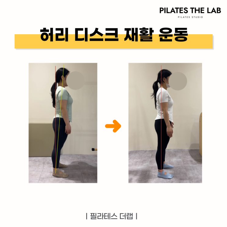  목동 필라테스 허리디스크 재활 운동 후기