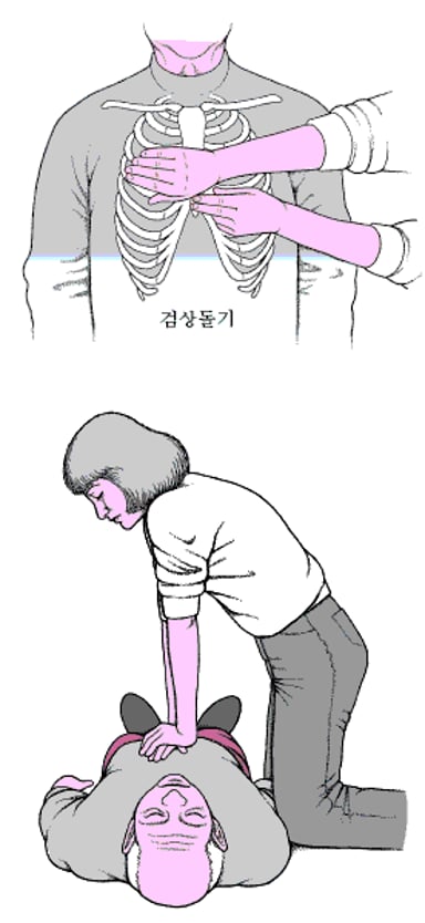 심장 정지 및 CPR