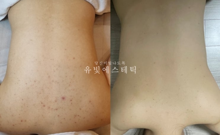 삼송 지축 등드름 약초필 알라딘필링 유빛에스테틱