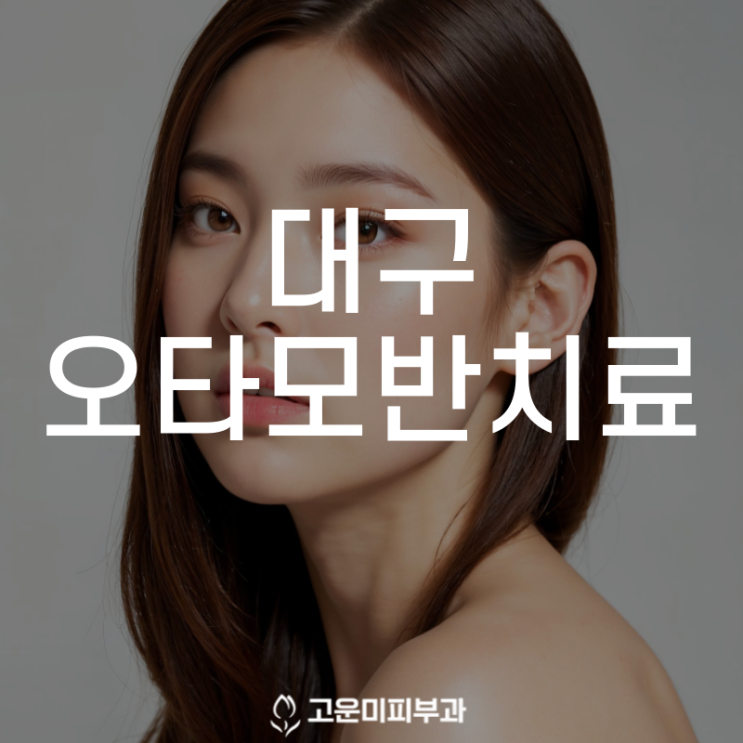  대구오타모반치료 눈 주위 생기는 푸르스름한 반점 피코 레이저로 치료합니다