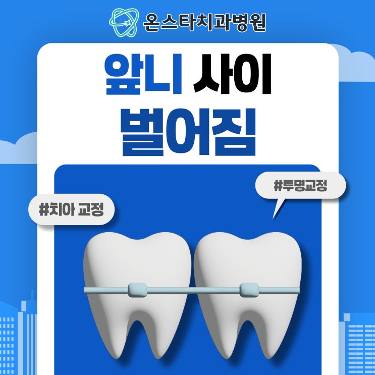  앞니 사이 벌어짐 원인과 치료 방법
