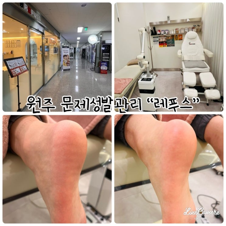  "레푸스 원주점" 체계적인 발톱관리로 고민해결해주는 원주 문제성 발관리샵(원주발각질)