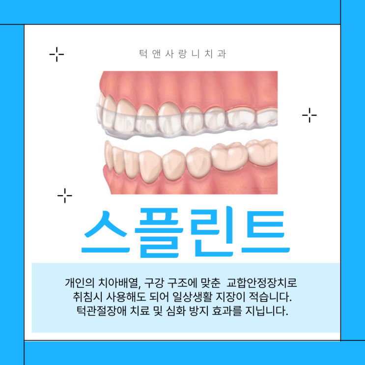  천안 고속터미널 이갈이 치료 스플린트