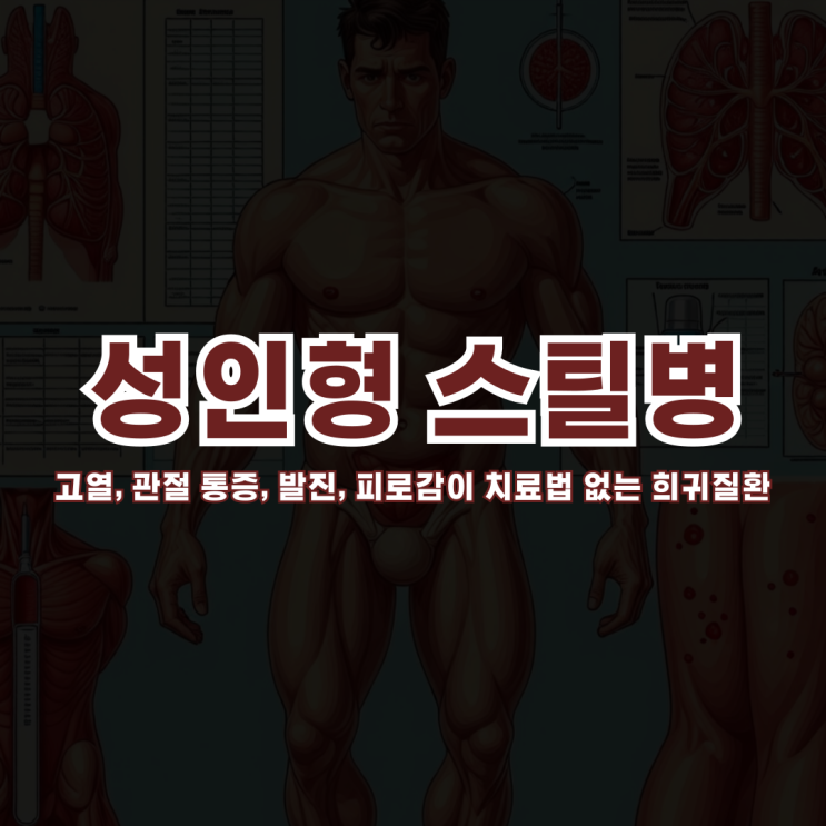  고열, 관절 통증, 발진, 피로감이 치료법 없는 희귀질환일 수도 있습니다! 성인형 스틸병