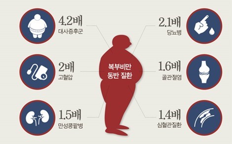  내장지방 빼는법 줄이는 팁 생활습관 영향