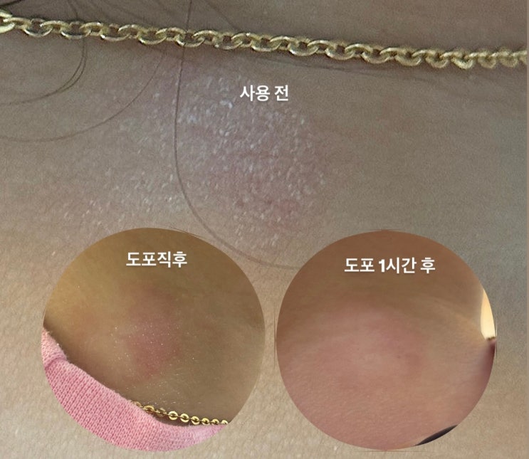 환절기 건조한 아기피부 베베숲 수딩앤모이스춰 로션으로 100시간동안 보습 지켜주기 ( 전/후 사진 有 )