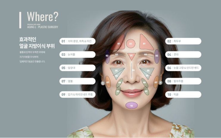  동안비결: 지방이식으로 살려주는 얼굴 볼륨