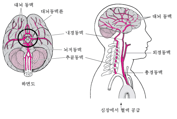 허혈성 뇌졸중