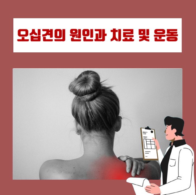  어깨에 통증이 심해 안 움직이는 오십견의 원인과 치료는 무엇일까?