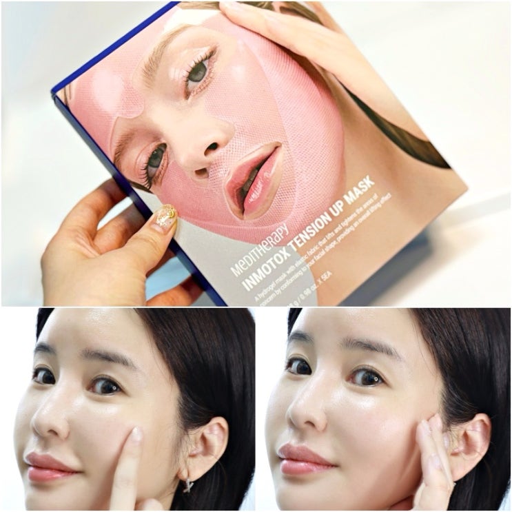 안면거상패치 붙이는 피부리프팅 메디테라피 인모톡스 텐션 업 마스크 안면거상패치 붙이는 피부리프팅 메디테라피 인모톡스 텐션 업 마스크