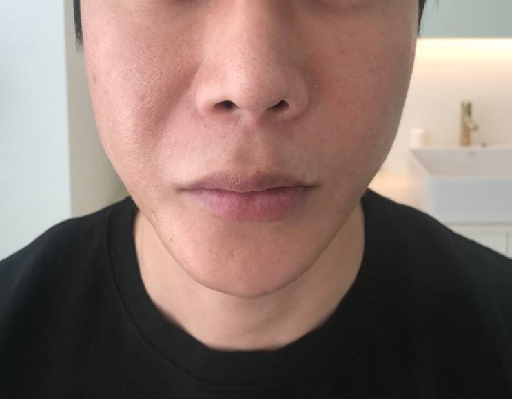  내지인 또데꾸 비포앤애프터 방문!ㅎㅎ